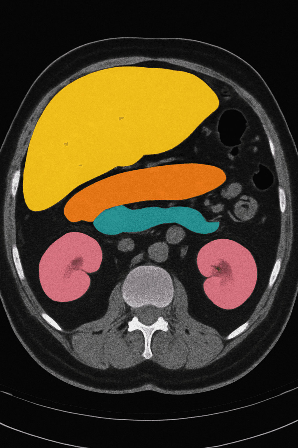 Medical Imaging Analysis